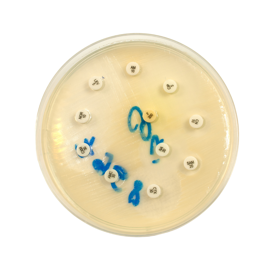 testes de suscetibilidade antimicrobiana